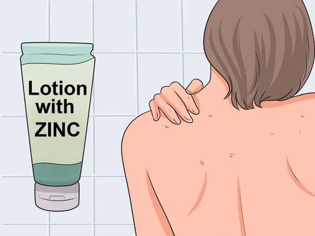 lotion with zinc