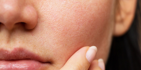 best moisturizer for combination skin